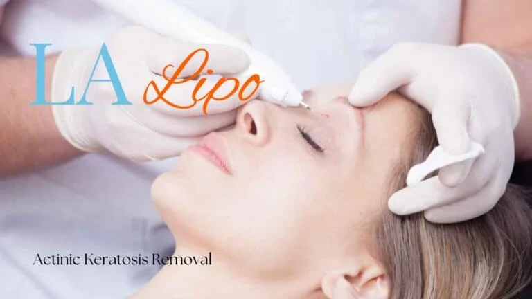Woman receiving Actinic Keratosis Removal Treatment Greenock 
