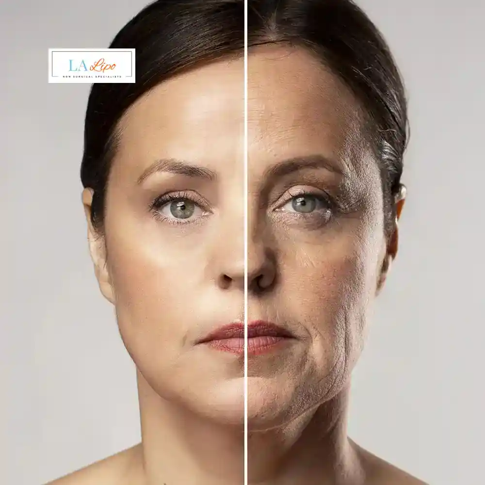 How Can You Tell If Non-Surgical Skin Tightening Is Right for You Greenock ?
